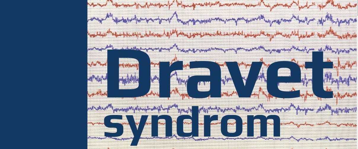 Grafisk fremstilling af EEG og navnet Dravet syndrom
